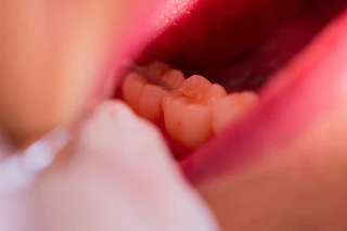 Nach einer Behandlung in einer Augsburger Zahnarztpraxis ist ein Patient gestorben. (Symbolbild) — © Rolf Vennenbernd/dpa