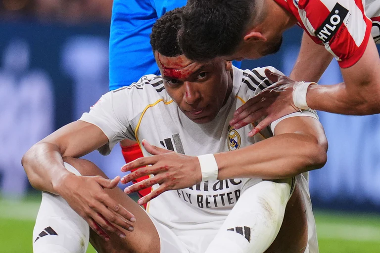 Mbappé wurde im Spiel gegen Girona im Gesicht getroffen. — © Manu Fernandez/AP/dpa