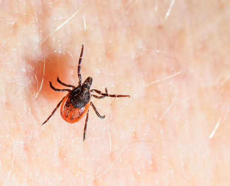 Der Gemeine Holzbock ist die häufigste Zeckenart in Deutschland und auch die, die hauptsächlich FSME und Borreliose auf den Menschen übertragt. (Archivbild) — © Patrick Pleul/dpa