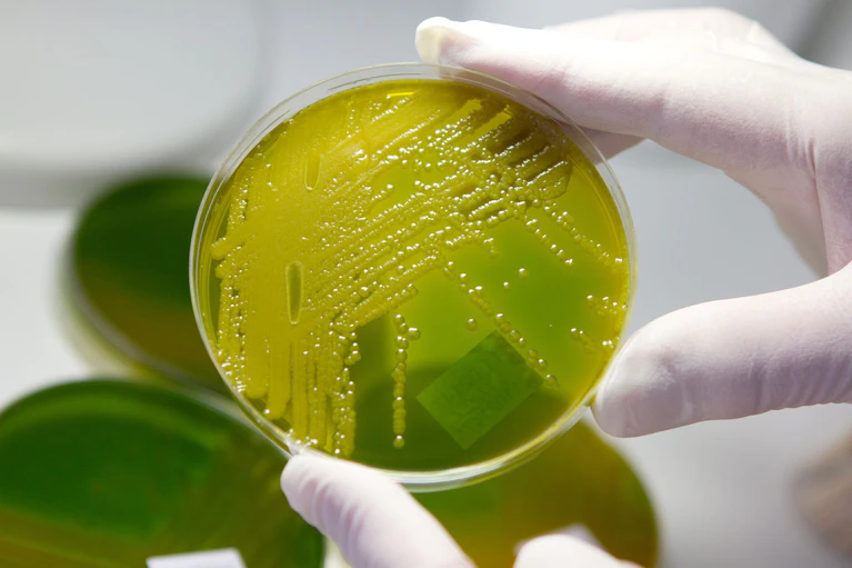 Ehec steht für enterohämorrhagische Escherichia coli und bezeichnet bestimmte krankmachende Stämme des Darm-Bakteriums, die vor allem bei Wiederkäuern wie Rindern vorkommen. (Archivbild) — © Matthias Bein/dpa-Zentralbild/dpa