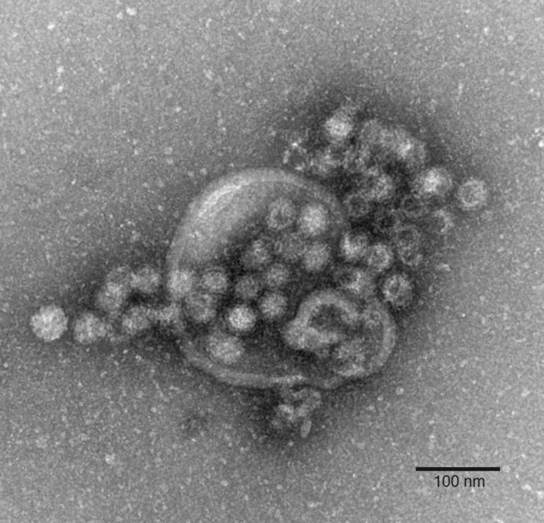 Das Norovirus ist sehr leicht übertragbar und gehört zu den weltweit häufigsten Erregern für plötzlich auftretenden Brechdurchfall.  — © Gudrun Holland/RKI/Robert-Koch-Institut/dpa